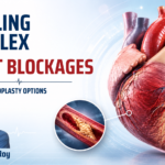 Medical infographic illustrating advanced angioplasty options for complex heart blockages, featuring a detailed human heart, coronary artery blockage visualization, stent placement techniques, and interventional cardiology treatments.