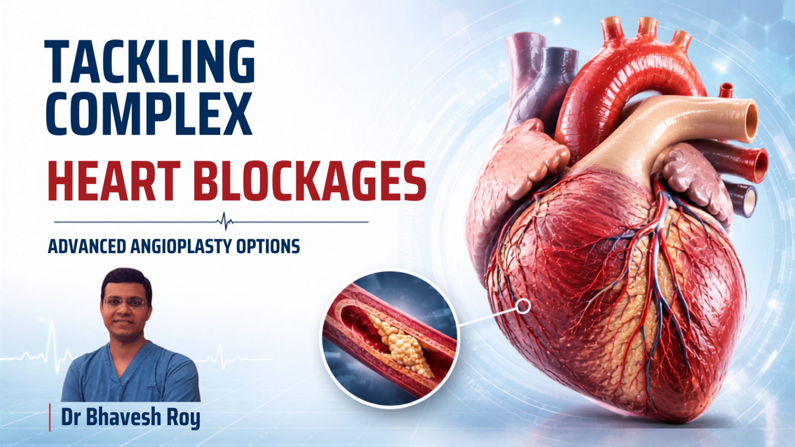 Medical infographic illustrating advanced angioplasty options for complex heart blockages, featuring a detailed human heart, coronary artery blockage visualization, stent placement techniques, and interventional cardiology treatments.
