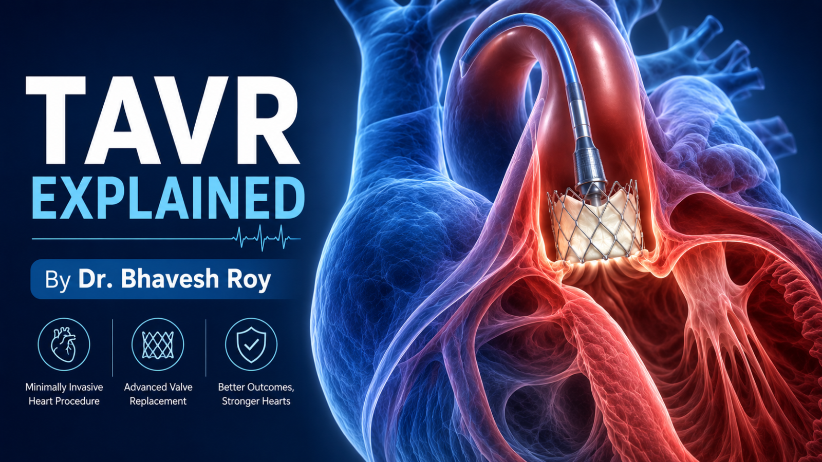 3D medical illustration showing the TAVR full form in medical procedure, replacing a diseased aortic valve without open-heart surgery.