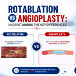 Infographic comparing Rotablation vs Angioplasty for coronary artery disease treatment, explaining that rotablation is used for heavily calcified coronary artery blockages while angioplasty is used for soft or moderately narrowed arteries. Features key differences, medical illustrations of both procedures, and Dr. Bhavesh Roy, Interventional Cardiologist.