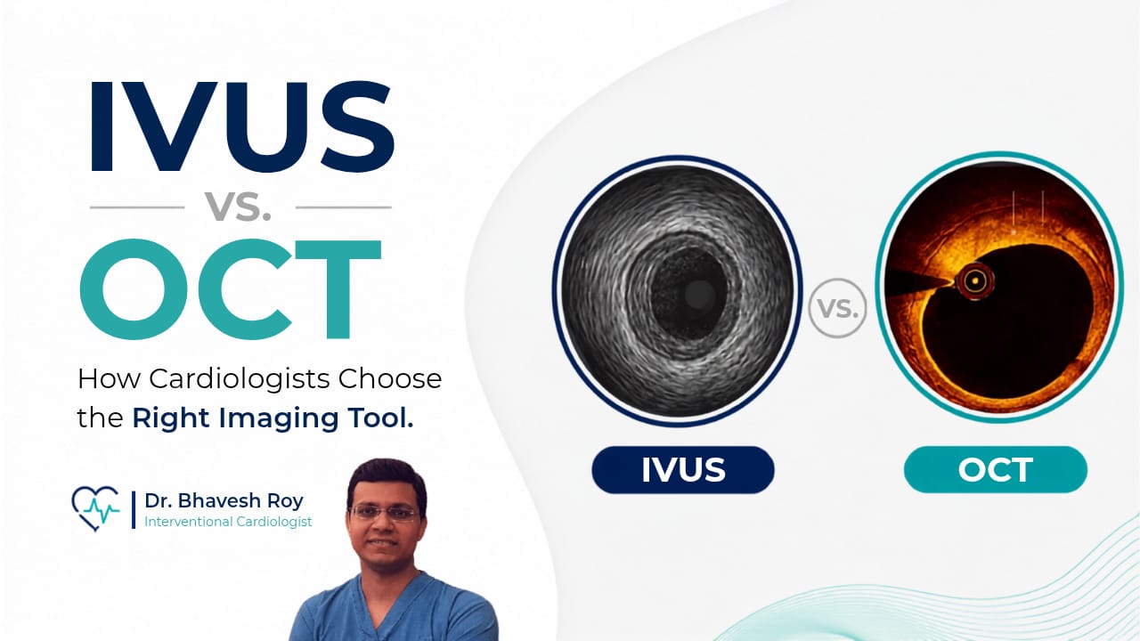 IVUS vs. OCT cardiac imaging comparison graphic featuring Dr. Bhavesh Roy, showing cross-sectional vessel scans.